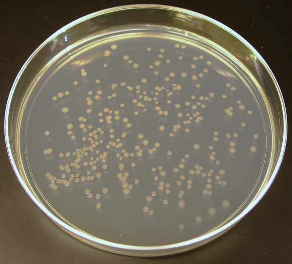 Bild på kolonier av E. coli som växer i en petrisskål.