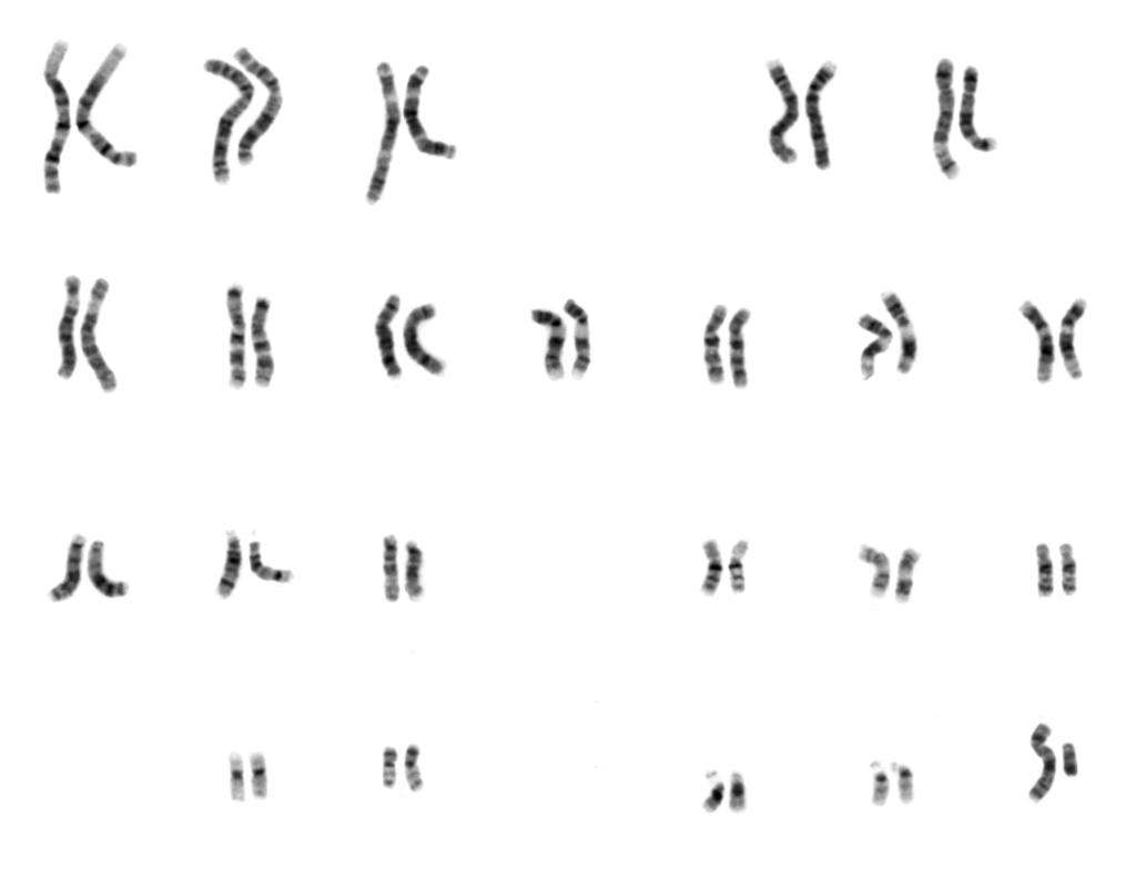 bild på människans karyotyp som består av 46 kromosomer