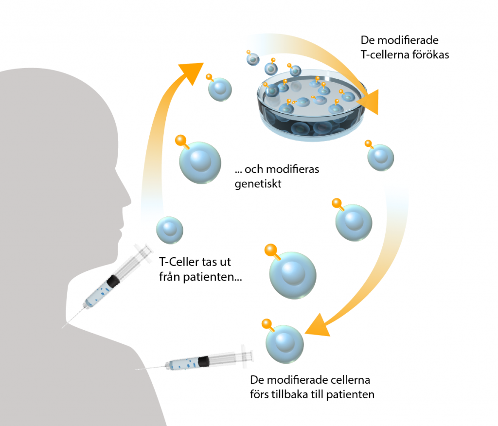 Vid en CAR-T-cellterapi tas T-celler ut från kroppen och modifieras genetiskt