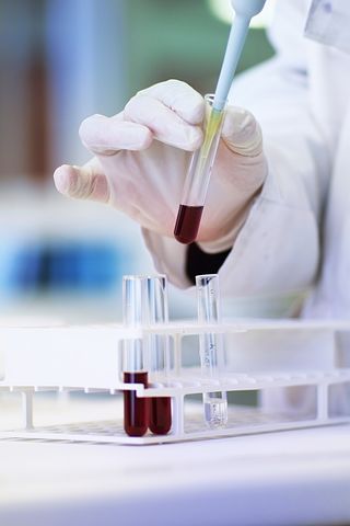 Bild på hand som pipetterar upp blod ur ett provrör i laboratoriemiljö.