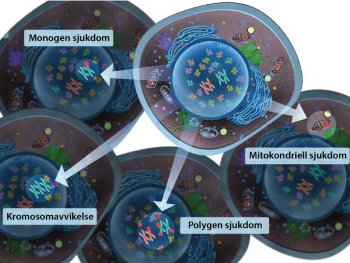 Illustration av monogena, polygena, mitokontriella sjukdomar och kromosomavvilkelser